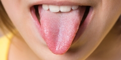 Червоний, білий, фіолетовий – про які небезпечні хвороби може розповісти колір язика