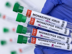 Новий штам смертельно небезпечної віспи mpox може вразити Європу – експерти радять готуватися